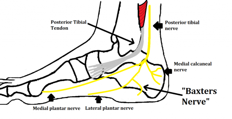 Baxters Nerve Entrapment Peak Podiatry