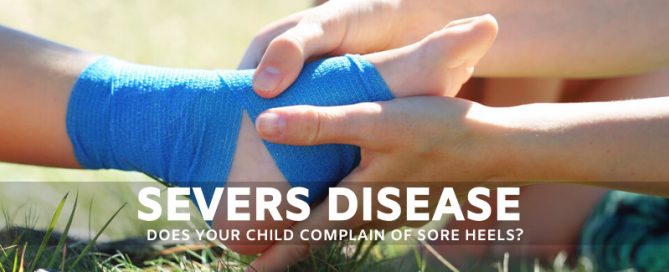 HEEL PAIN IN CHILDREN – SEVERS DISEASE