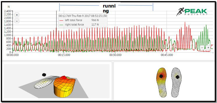 Peak s Plantar Pressure Assessments Peak Podiatry